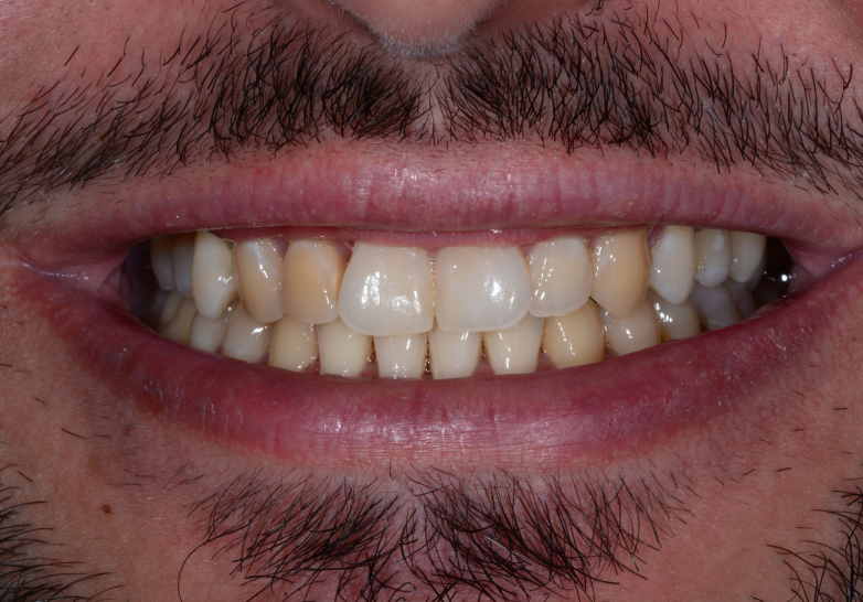 Before image 1